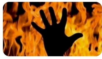 चिल्ड्रन पार्क के सार्वजनिक शौचालय में व्यक्ति ने खुद को लगाई आग ,