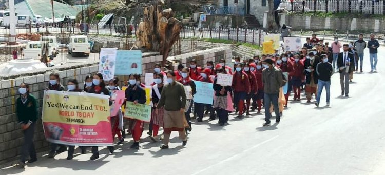 विश्व क्षयरोग दिवस पर आयोजित जागरूकता रैली को उपायुक्त ने दिखाई हरी झंडी