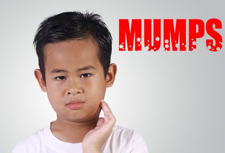 बच्चों में मंप्स रोग के प्रति ऐहतियात बरतें