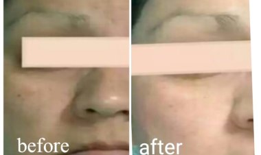 आयुर्वैदिक चिकित्सा पद्धति से जिला के चर्म मरीजों को मिल रहा अत्याधिक लाभ - डॉ. इंदु शर्मा