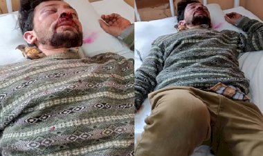 जुन्गा में होली पर एचआरटीसी के ड्राइवर कंडक्टर की बेरहमी से धुनाई, दोनों आईजीएमसी में उपचाराधीन