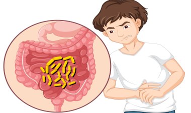 20 फरवरी, 2025 को 1 से 19 साल के बच्चों को कृमि नियंत्रण की दवाई खिलाई जाएगी