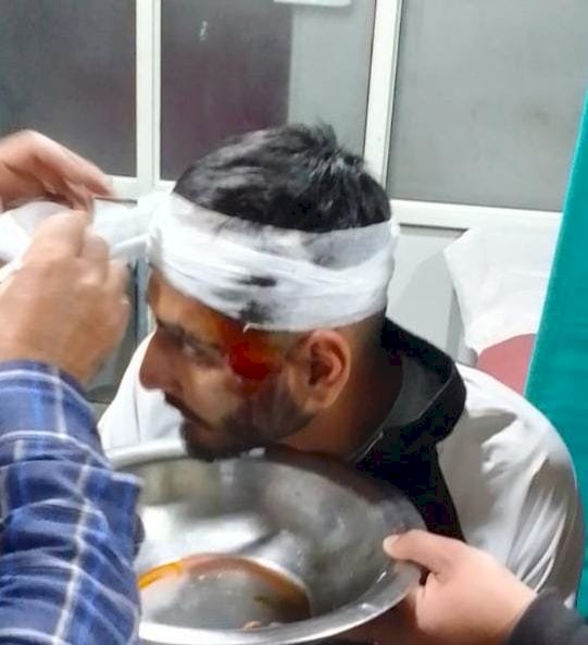 प्रदेश विश्वविद्यालय छात्रों के दो गुटों में खुनी जंग, आधा दर्जन हुए घायल