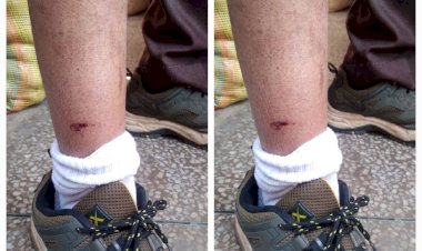 नाहन: नया बाजार में व्यापारी को, कच्चा टैंक में स्कूली छात्रा को काटा लावारिस हमलावर कुत्तों ने..