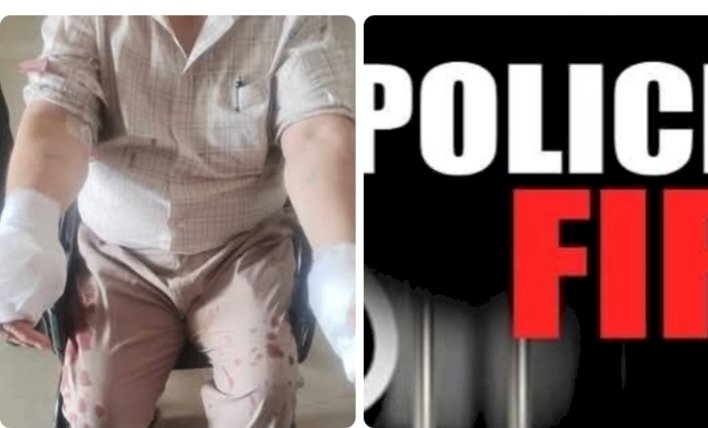 नाहन: दो सगे भाईयों के जमीनी विवाद में खूनी झड़प, छोटे भाई ने दराट से किया हमला, गर्दन पर किया वार, हाथ का अंगूठा कटा एफआईआर दर्ज...
